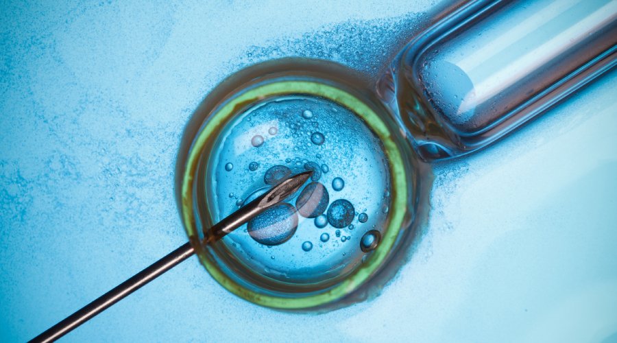 Intrauterine Insemination (IUI)