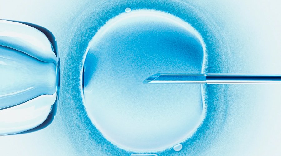 In Vitro Fertilization (IVF)